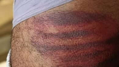 Photo of जमीनी विवाद में फार्मर की बेरहमी से पिटाई, गुप्तांग में डाला डंडा